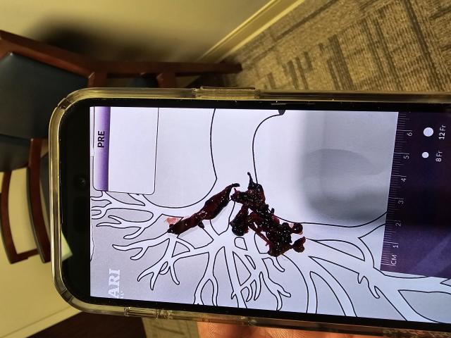 [Linked Image]