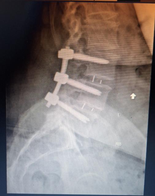 [Linked Image]